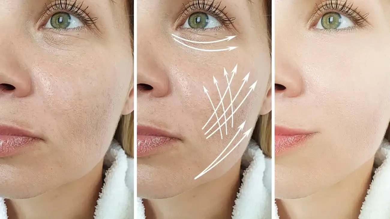 Can One Treatment Really Tackle More Than One Skin Concern Dunstable?