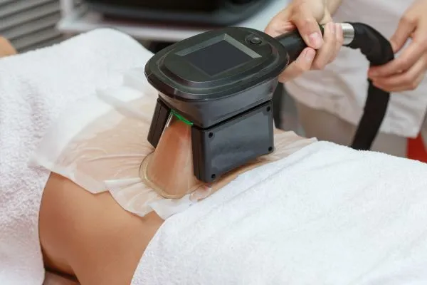 Image of person having fat freezing treatment to help weight gain Dunstable