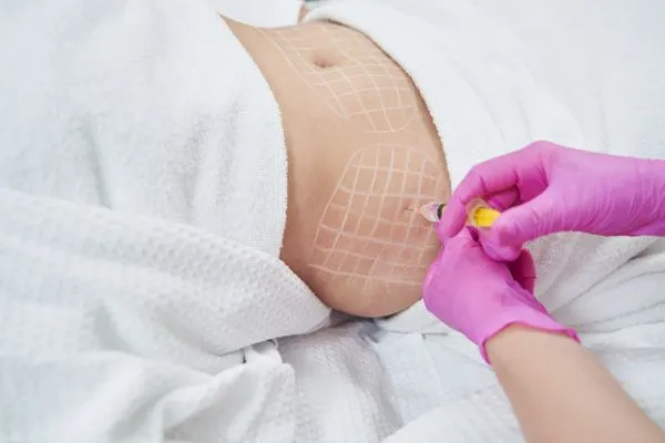 image of fat dissolving injections on love handles to help combat weight gain Dunstable