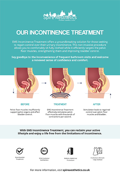 image of how urge incontinence Dunstable treatment works