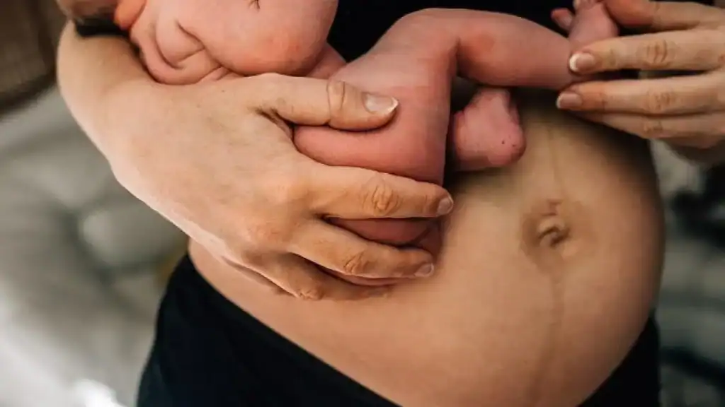 Why Is My Stomach Still Big After Pregnancy Dunstable?